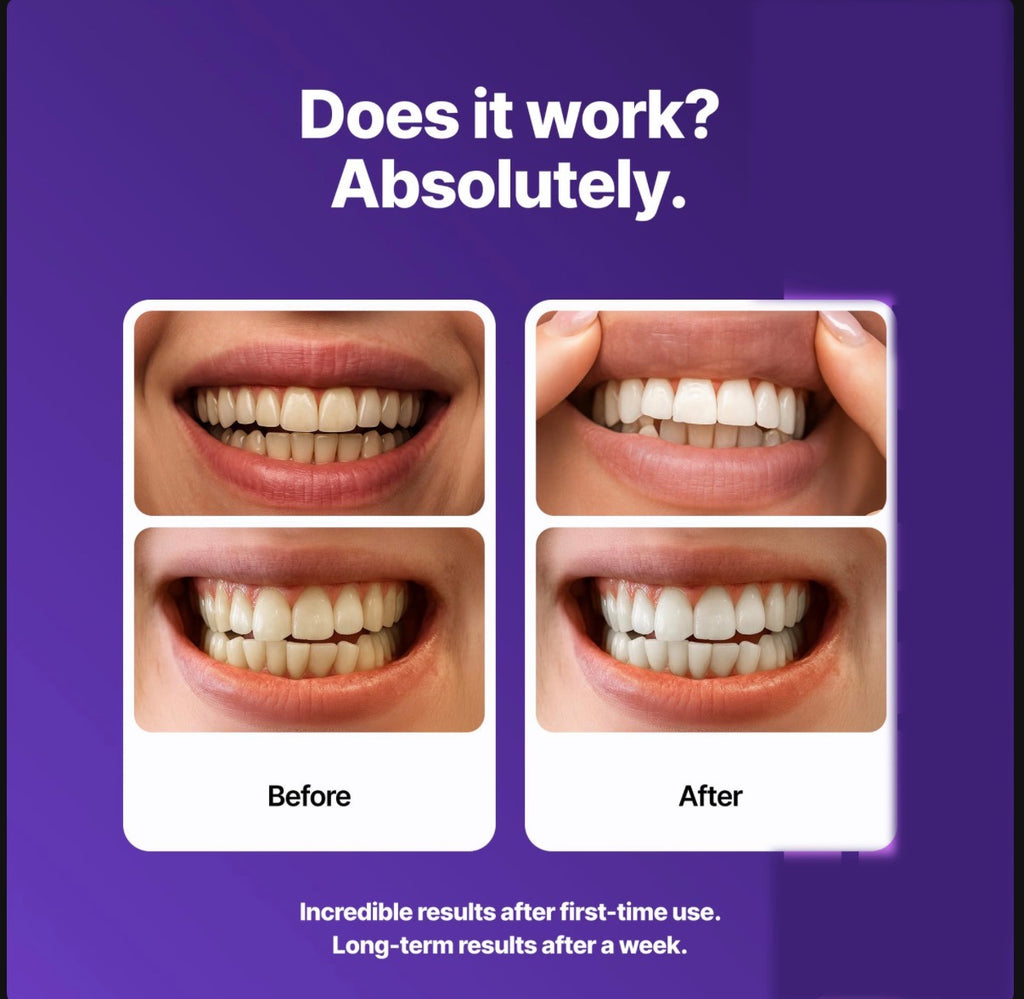 Dr Dent Teeth Whitening Strips