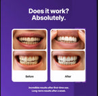 Dr Dent Teeth Whitening Strips